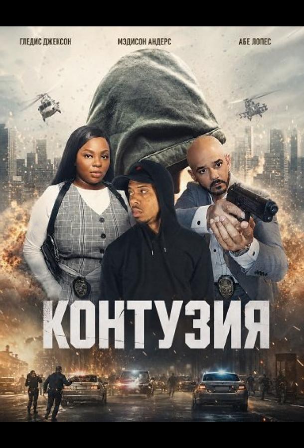 Контузия